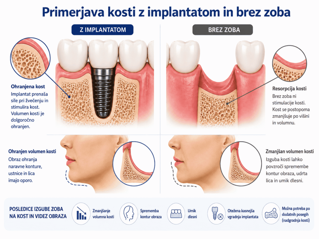 Zobozdravnik Reka – primerjava kosti z implantatom in brez zoba
